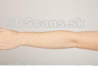 Photo reference of forearm 0001